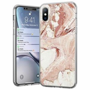 Wozinsky Marble, Xiaomi Redmi Note 10 / Redmi Note 10S, růžový